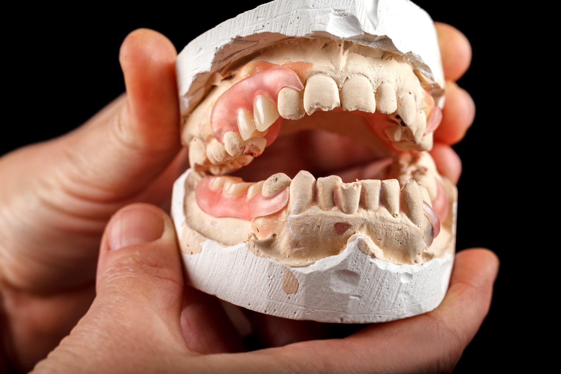 A denture on a gypsum base in the hand of a dentist. Close-up on a black background